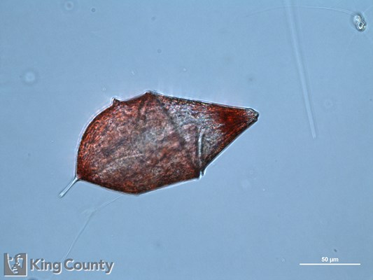 Photo of Gyrodinium spp.